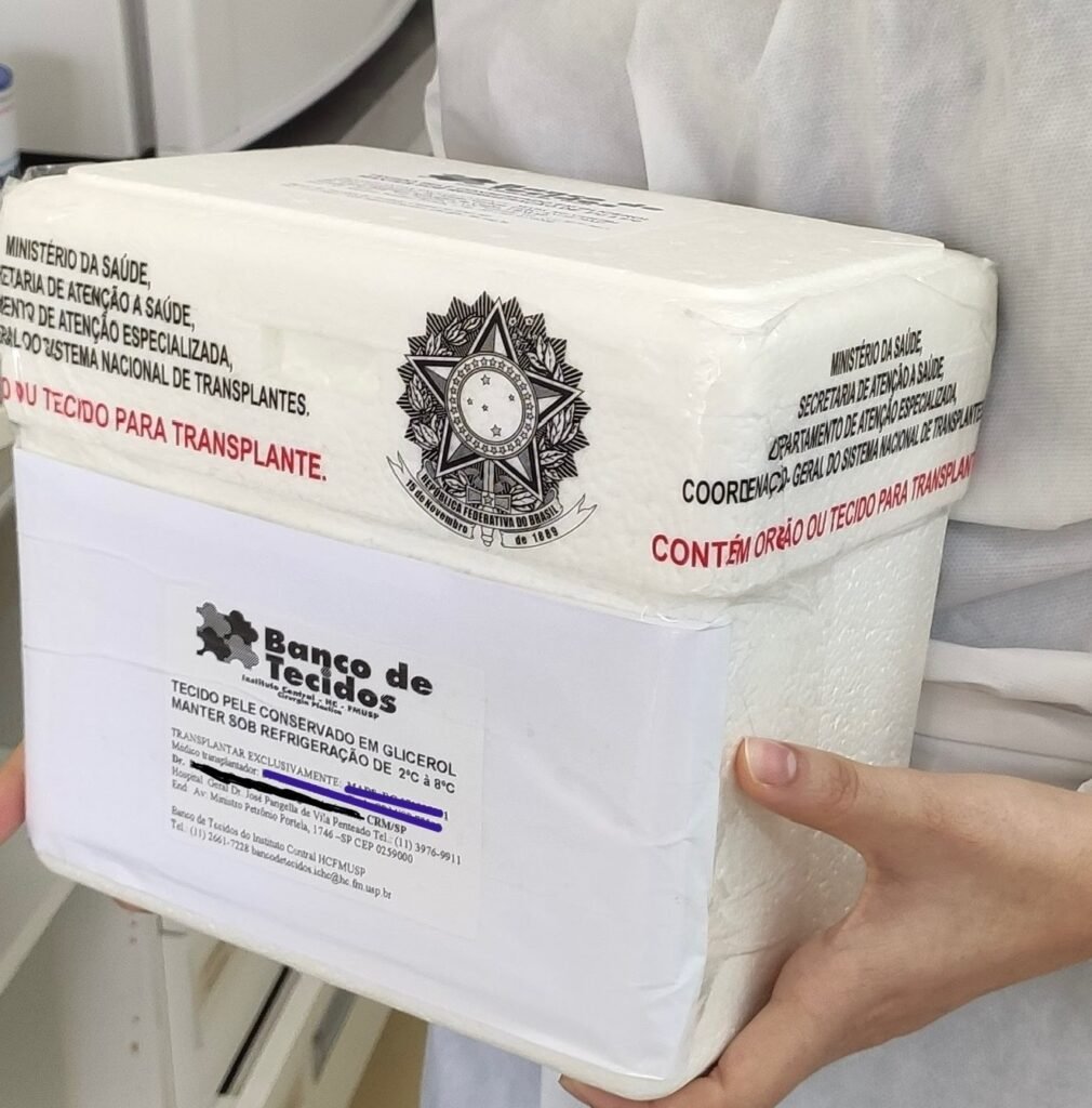 A pele é um órgão que pode ser doado e transplantado. A foto mostra uma pele sendo transportada e acondicionada adequadamente em caixa de isopor com gelo para servir de enxerto de pele.