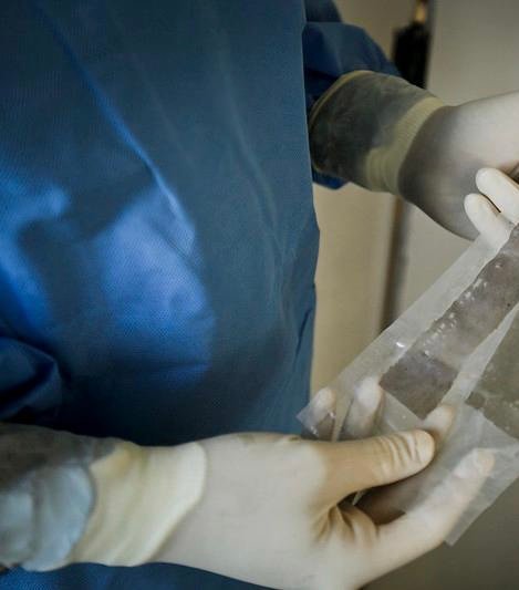 Imagem mostrando um cirurgião plástico com paramentação estéril manuseando uma placa de plástico contendo um enxerto de pele logo antes do transplante.