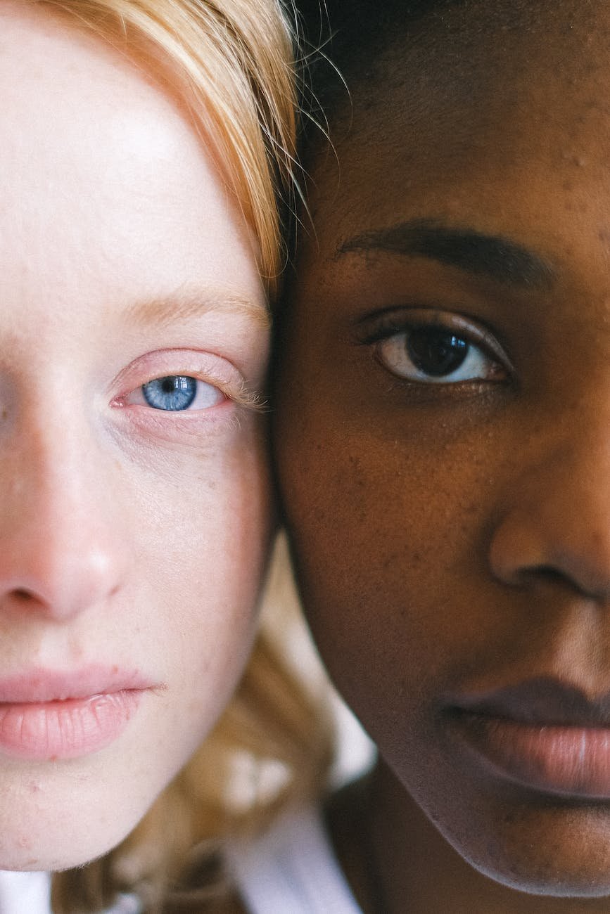 Imagem com duas mulheres de fototipos opostos. A pele mais clara, principalmente com olhos claros, exige mais cuidados para manter a jovialidade. A cirurgia plástica, toxina botulínica (Botox) e cosmiatria ajudam nesse processo, em Catalão e região.