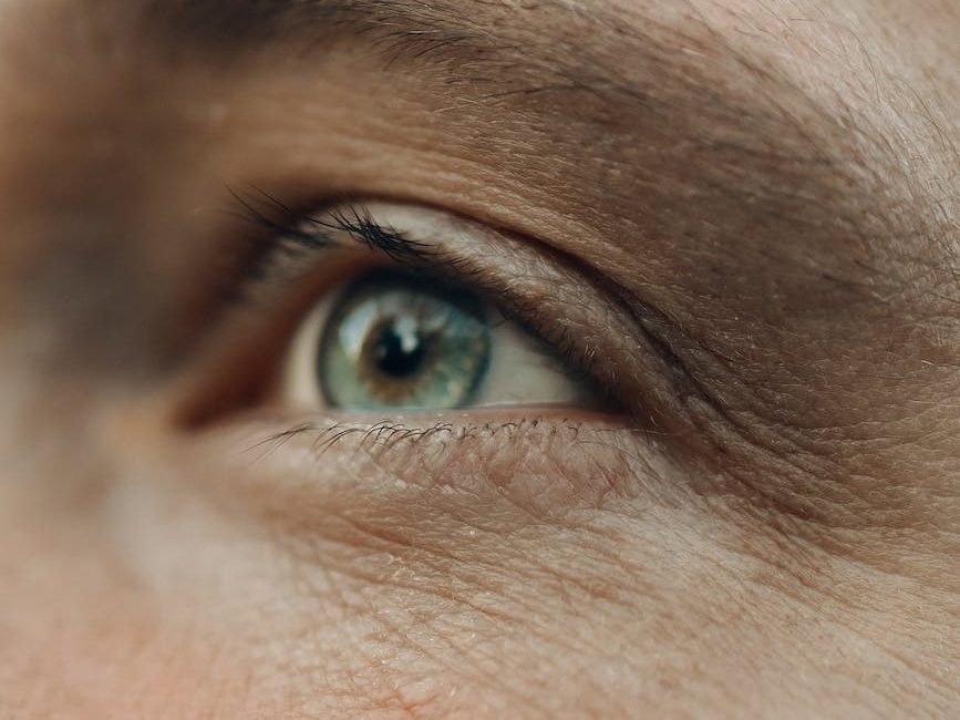 O envelhecimento da região do olhar e do rosto pode ser tratada com cirurgia das pálpebras (blefaroplastia), lifting do rosto (facelifting ou ritidoplastia) e lifting labial (liplifting). Essa imagem mostra um olhar com sinais de envelhecimento, que pode se beneficiar dos procedimentos citados.