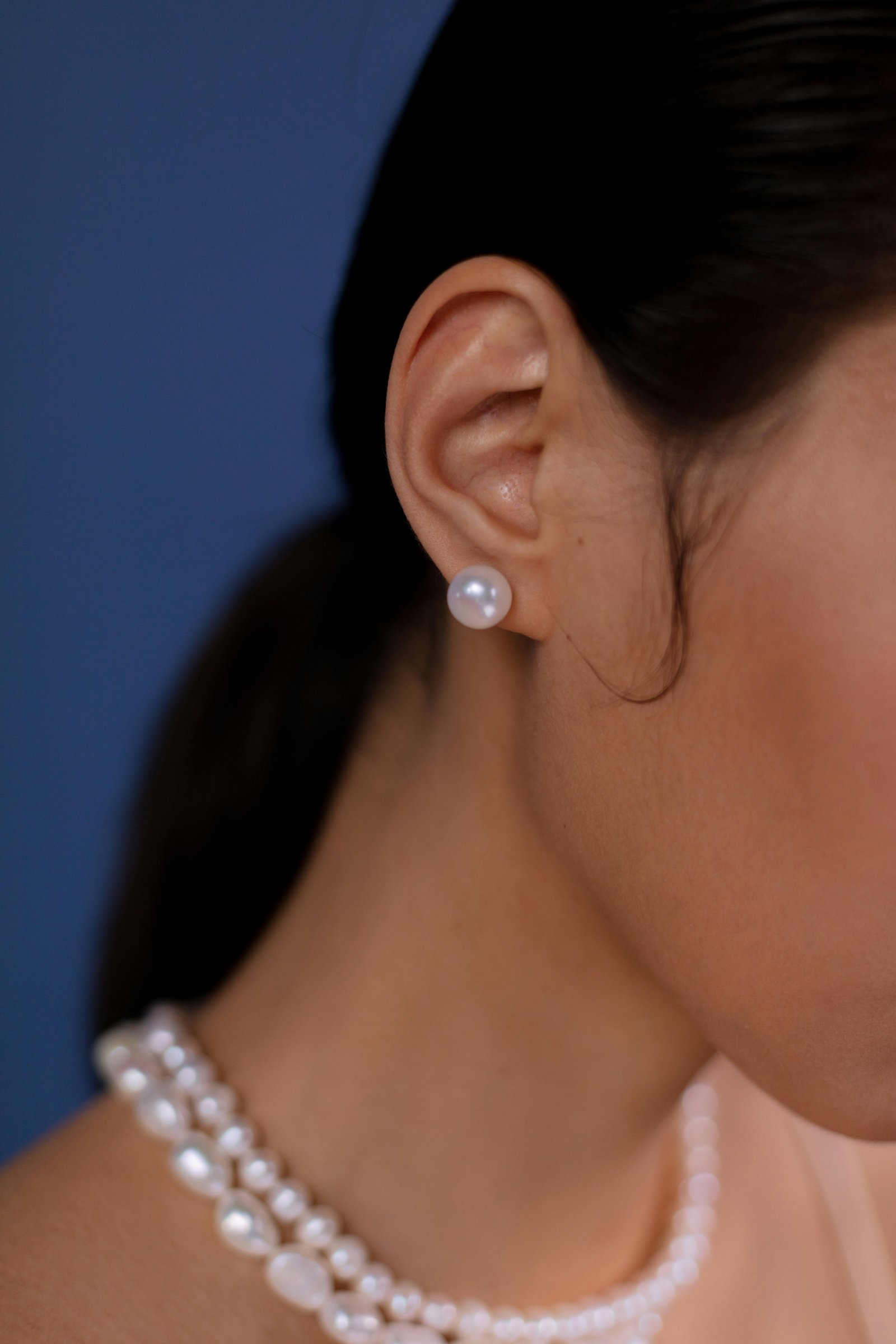 Cirurgia plástica da orelha: otoplastia (que é correção de orelha em abano) e lobuloplastia (que é correção de orelha rasgada. Elas melhoram a aparência da face e autoestima, favorecendo o paciente a expor a orelha em público. Essa cirurgia plástica é realizada em Catalão.